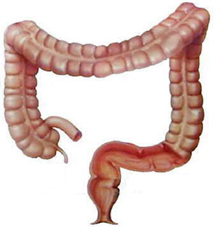 Sites of colonoscopic delivery of stool